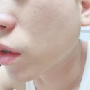 휴앤코스메틱 | 스킨천사 좀비팩 추천 리얼후기