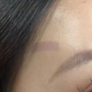 박앤리피부과의원 이미지