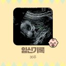 아란태산부인과의원 | 임신기록 30주(병원전원, 산부인과 전원, 분만병원 결정 기준, 정밀초음파, 아기크기, 주수대비크기, 열...