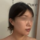 에스테틱더맑은 | 용산피부관리 에스테틱 더맑은스킨 신용산점 수분관리 후기