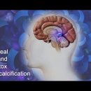 송과선(제3의 눈)을 탈(脫)석회화 하는 방법 (How to Decalcify Your Pineal Gland) 이미지