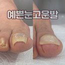 예쁜눈고운발