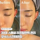 센트라스 골프존 | ♥웨딩준비18. 왕십리에스테틱 추천 오닉스스킨테라피 (예신관리9탄)