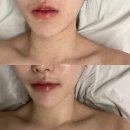 수지 성복역 피부관리 에스테틱혜윰 솔직 후기