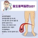 찌릿&#39; 운동 중 다리 경련 잦다면 &#39;이 질환&#39; 의심해야 이미지