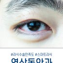 첫눈애안경이랑콘택트 네이버블로그