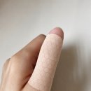 방아쇠수지 치료법 개인적인 후기 (방아쇠증후군치료법, 방아쇠수지증후군치료, 방아쇠수지증후군수술,,) 이미지