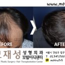 모재성성형외과의원 이미지