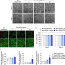 청담예가 | 리투오 쥬브아셀 효과 후기 비교 원장이 조심스러워하는 내용