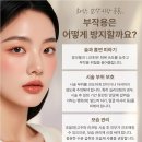 대한소프트 | 실루엣소프트리프팅 관심있다면 선택