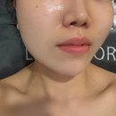 hy 연수점 | 송도 타임스페이스 에스테틱 추천 시바산 발삼관리 추천 오블리스킨