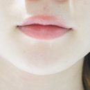 대치성모여성의원 | 선릉역 여자 인중 제모 대치성모여성의원 후기