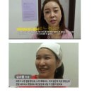 씨에이치에스