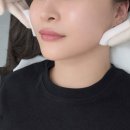 아르뷰 | 울산 서동 뉴아르뷰티, 이중턱 고민이라면? 공기압 앰플 관리 ‘페이스톡’ 후기