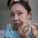 연세보드미의원 네이버블로그