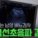 전립선 초음파 검사 [Prostate ultrasonography] 이미지