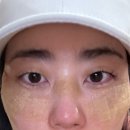 태강한의원 | 『대연동 피부관리』 트렌스포머 색소클리어링 잡티제거 후기 “제니룸스킨위드바디”