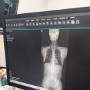 노원삼성정형외과의원 | 노원삼성정형회과 후기(MRI 검사)
