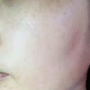 도움약국 | 엠디스픽 테카테카 징크 PCA 클리어 크림 RX 30ml 후기｜흔적 케어에 도움 되는 약국 크림