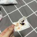 다인약국 | 부평 백운 다인이비인후과 비염수술 하비갑개 고주파 레이저 시술 3주차 후기