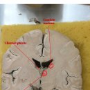 Coronal section 이미지