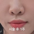 청담피부