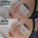 양을로 | 목포 세라링 3세대 스킨플래닝 711뷰티 후기 물광피부 되는 진짜 관리 피지 가시털까지 싹