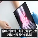 손발저림 감자가 특효 이미지