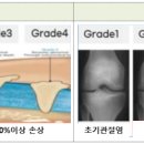 I012 이미지