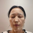 아임쏘리포마이스킨 젤리마스크팩 후기 수분폭탄 환절기마스크팩