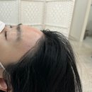 구월동 디어제이 왁싱&amp;뷰티 헤어라인 왁싱 후기