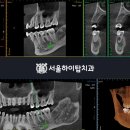 서울하이탑치과의원 이미지