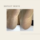 리풋(ReFOOT)