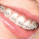 고운 치과기공소 이미지