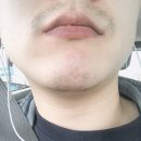 송준호레이메디의원 네이버블로그