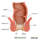 뉴젠의료기 네이버블로그