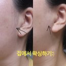 활용천 | 똥손도 쉽게하는 슈가링 셀프왁싱후기