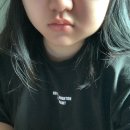 [대구 수성퍼스트치과] 매복사랑니 발치 후기