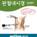 관절내시경, 무릎특화병원, 관절수술, 무릎통증, 반월상연골판파열, 십자인대파열 이미지