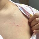 원투쓰리포차 | [ 출산 후기 ] 한빛여성 병원 전치태반 제왕절개 1일차, 2일차 ( 리얼 찐 후기 )