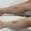 머클왁싱&에스테틱