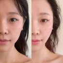 [경락 유목민 정착 내돈내산 후기] 홍대 신지윤피부관리에서 황금비율 비대칭 관리 받았어요!