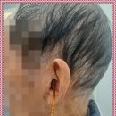 강원의료기.벨톤보청기 | 시그니아독일보청기 태백센터에서 벨톤 신제품 착용해 본 솔직 후기