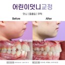 센텀어린이치과의원 네이버블로그