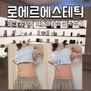고고에스테틱 | 마산에스테틱 로에르에스테틱 복부관리 만족 후기