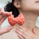 목 주변 혹, 갑상선결절일 수 있을까요?│의왕참조은내과의원