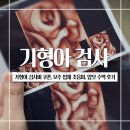 중앙보건지소 화장실(4층) | 대구 달성군 기형아 검사비 쿠폰 신청, 13주 4D 입체 초음파, 여성아이 입덧 수액 후기