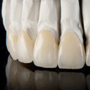 캐드피아치과기공소 이미지