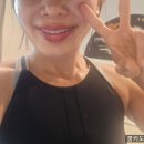 판교교정치과 40대 치아교정 인비절라인 후기! 마무리 단계