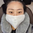이루미네일 | 광주 두피문신 출두smp 광주점 솔직 방문후기 M자 탈모 고민해결